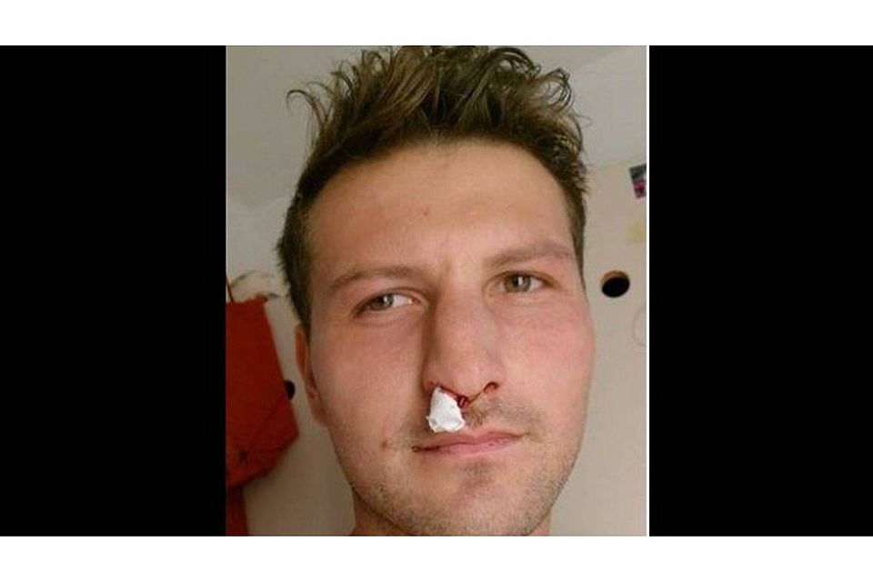 Erlitt seinen vierten Nasenbeinbruch im Spiel gegen den 1. FC Garmisch-Partenkirchen: David Balogh Foto: Balogh