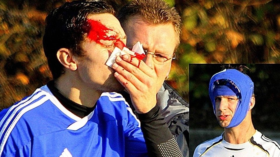 Einen komplizierten Nasenbeinbruch hat sich Bogens Spielertrainer Florian Schrepel zugezogen - Hutthurms Daniel Freund musste an der Schädeldecke genäht werden   Foto/Montage:Siering