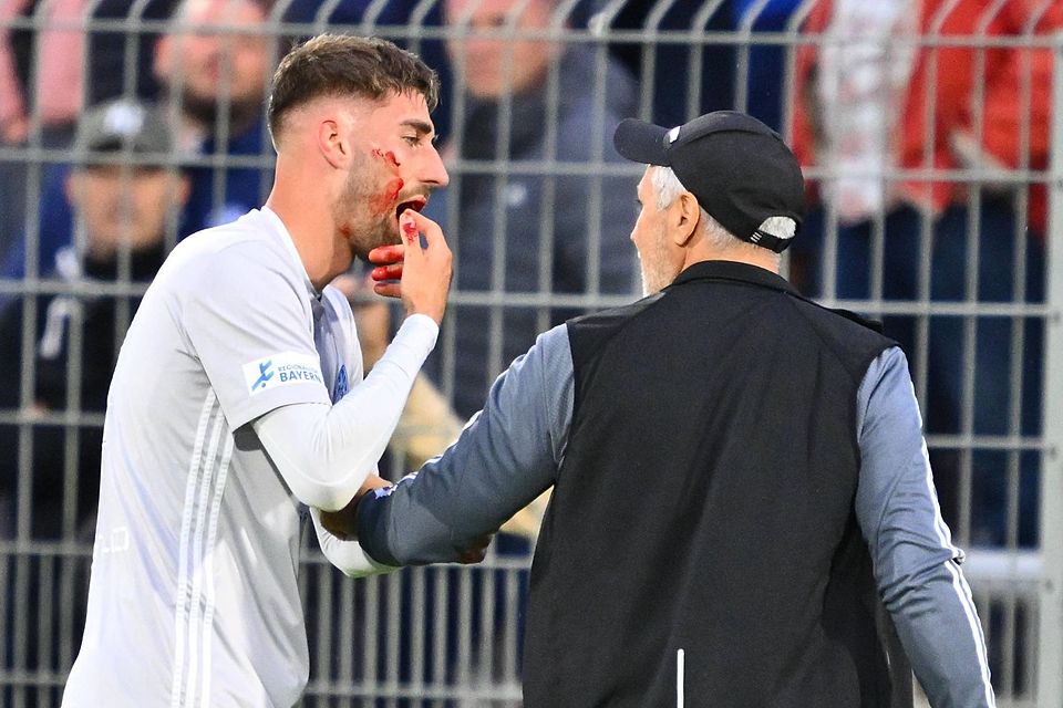 Niklas Biehrer (li.) blutet aus dem Mund. Der 25-Jährige hatte sich im Relegations-Rückspiel einen Kieferbruch zugezogen, spielte aber dennoch bis zum Ende durch.